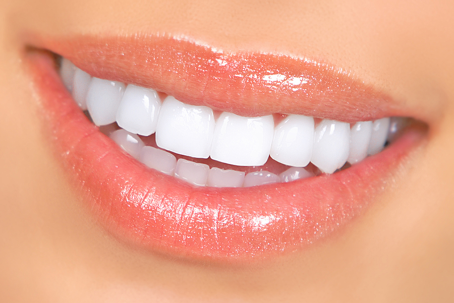 Everything You Need to Know About Dental Implants